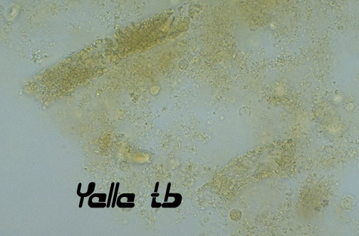 granular cast