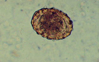 Ascaris ova