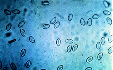 Enterobius vermicularis 