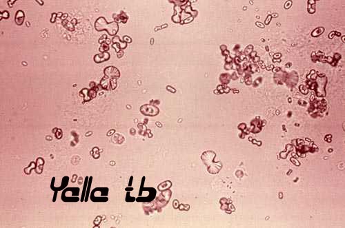 Ca Oxalate crystals 2