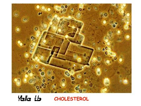Cholesterol