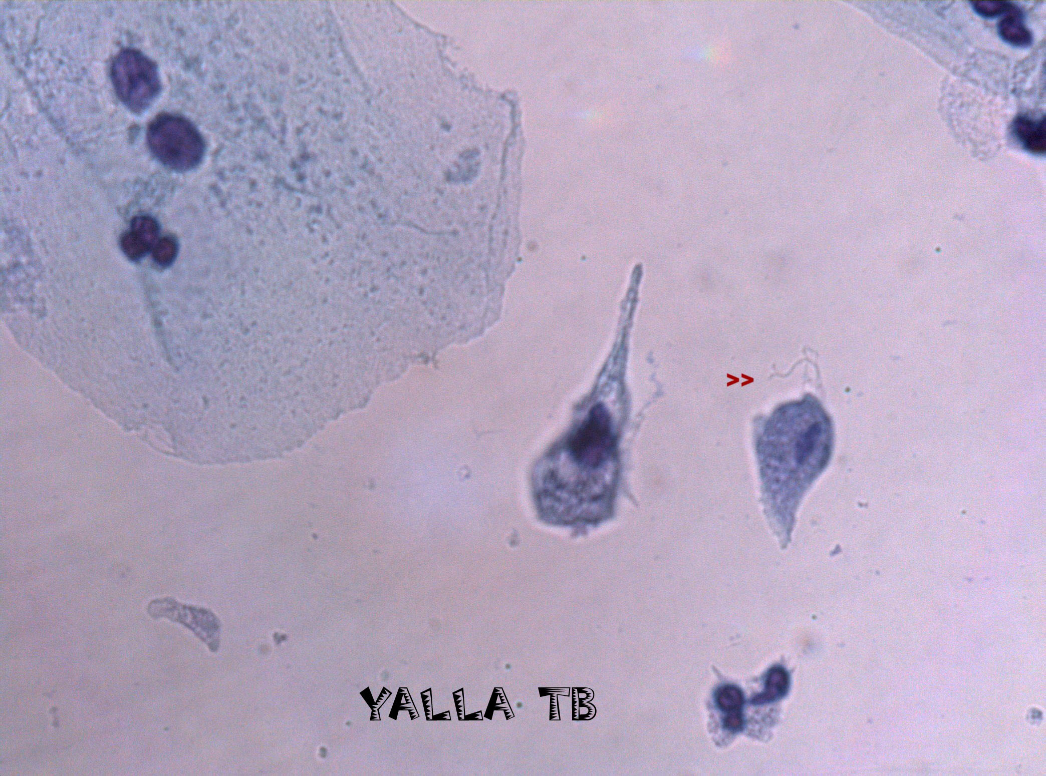 Trichomonus vaginalis 2