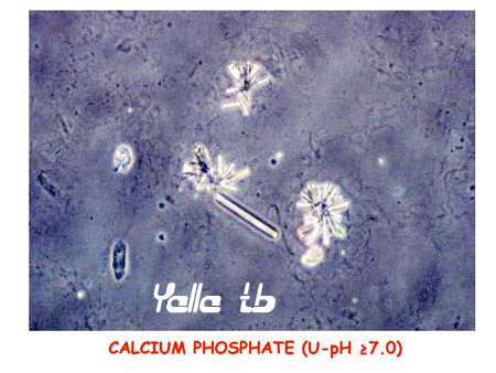 Calcium Phosphate