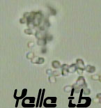 Yeast in Urine