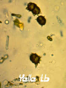 Ammonium Biurate Crystals