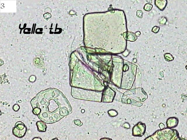 Uric Acid 3