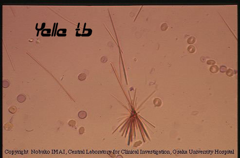 Safranine in urine