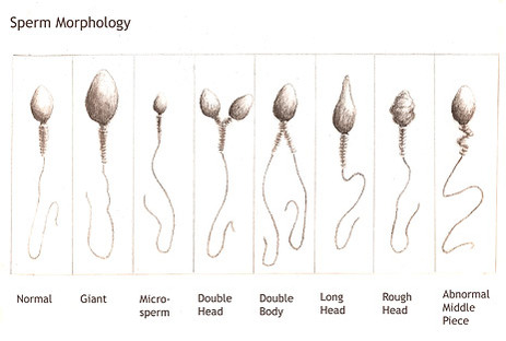 Types of sperms