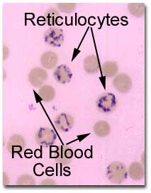 Blood reticulocytes