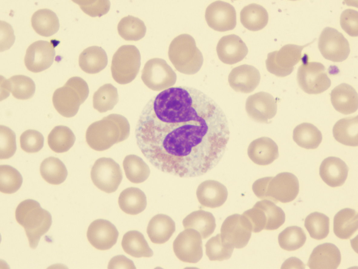 Eosinophil