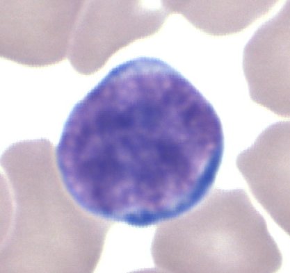 Big Luymphocytes