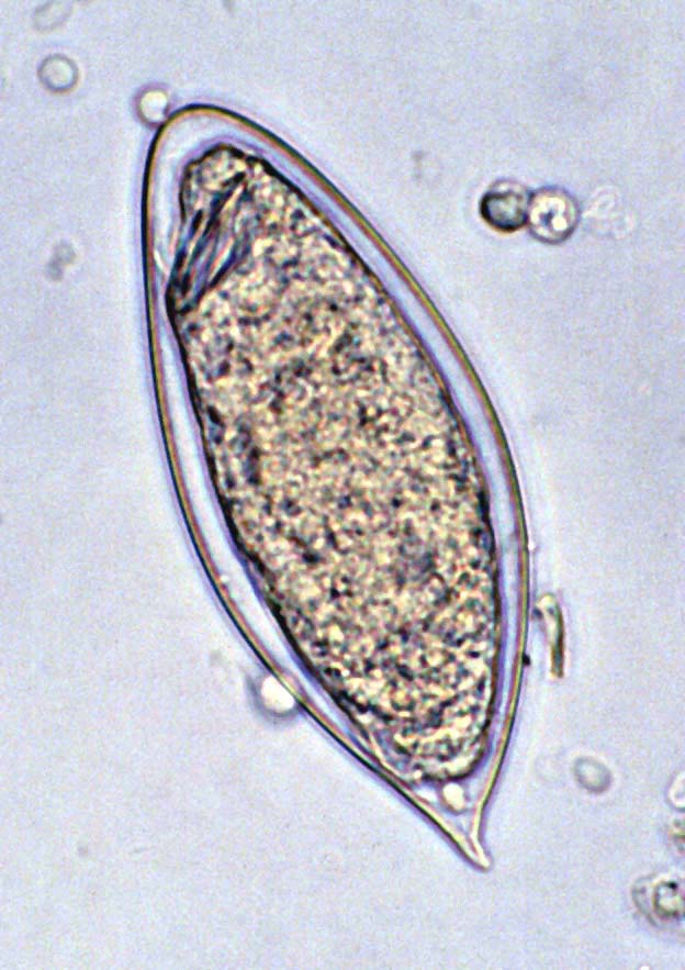 Schistosoma haematobium