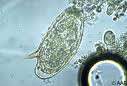 Schistosoma mansoni