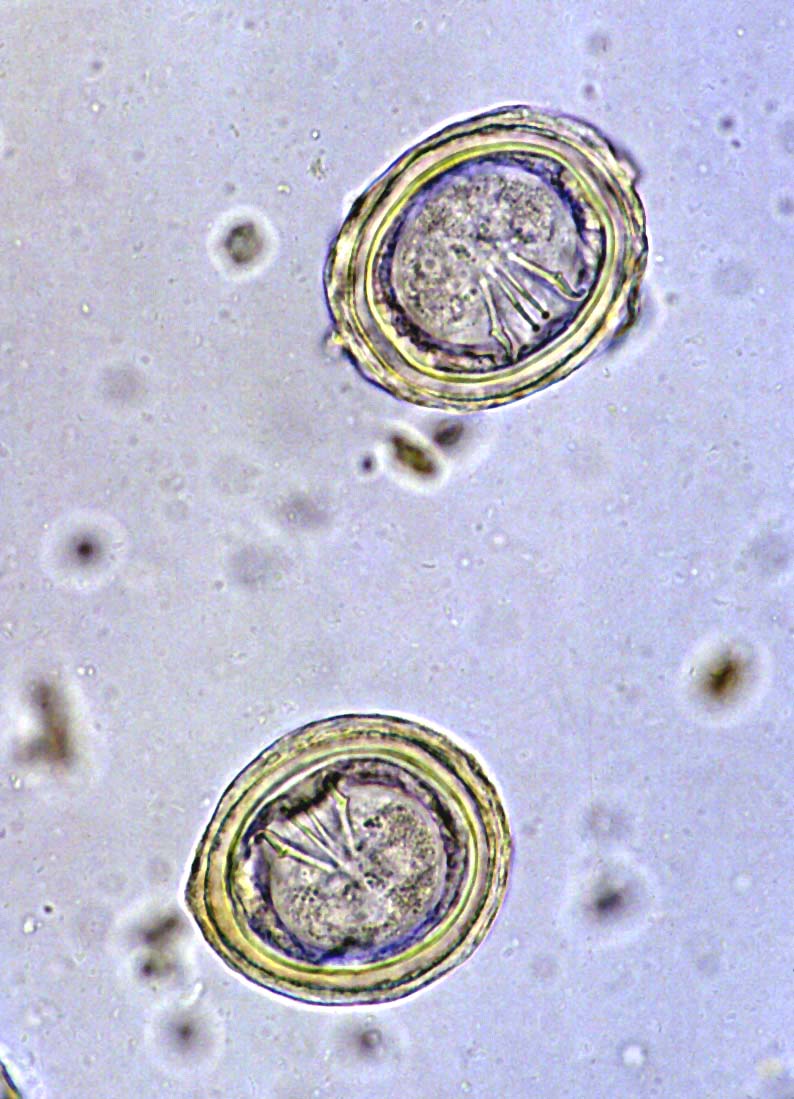 Choanotaenia