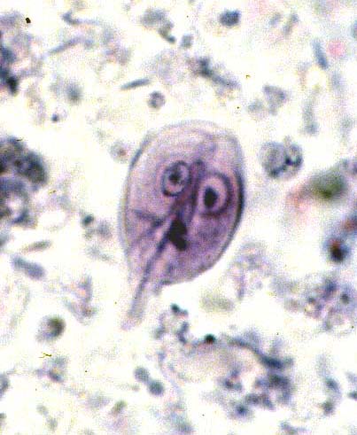 Geardia Under microscope 2