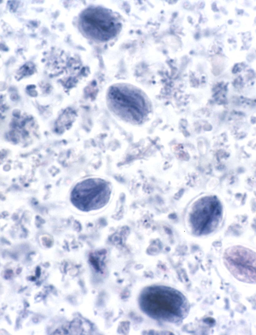 Geardia Under microscope 3